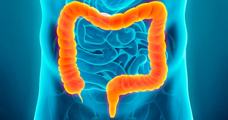 Coloproctología