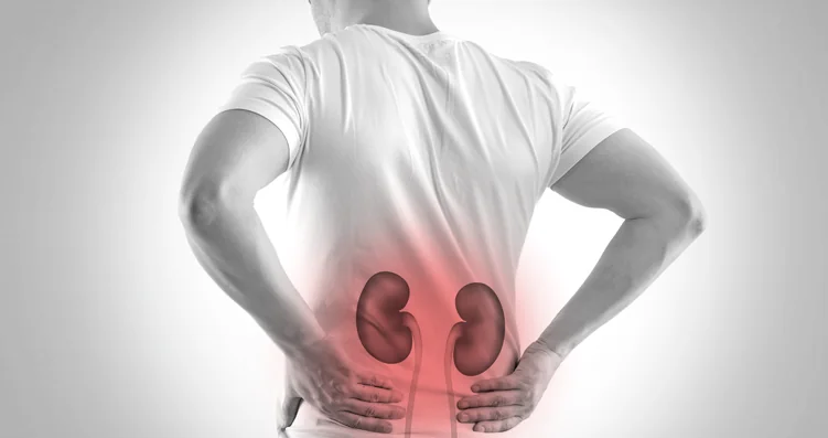 UroParque, Unidad de Litiasis y Endourología